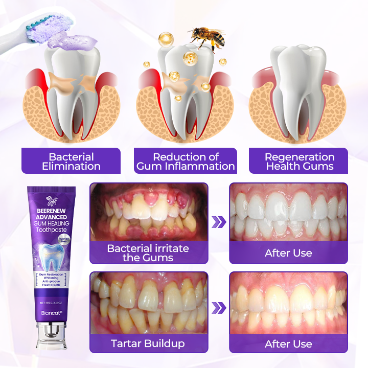 Biancat® BeeRenew Advanced Gum Healing Toothpaste