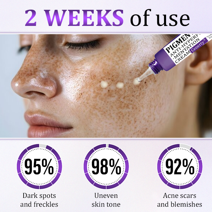 Ceoerty® PigmentaX ProFade Anti-Hyperpigmentation Cream⭐