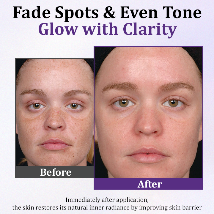 Ceoerty® PigmentaX ProFade Anti-Hyperpigmentation Cream⭐