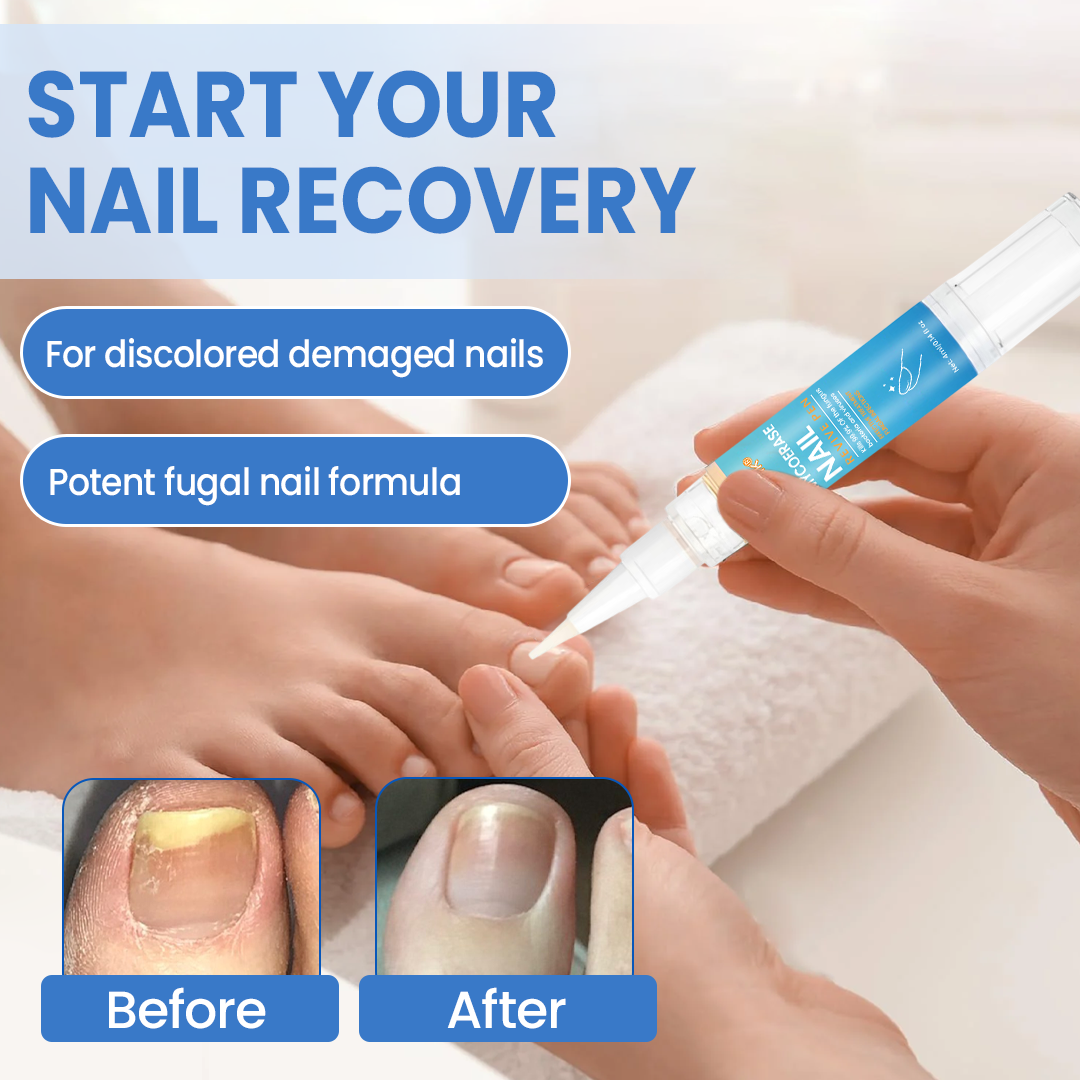 Timilk® MycoErase Nail Revive Pen⭐