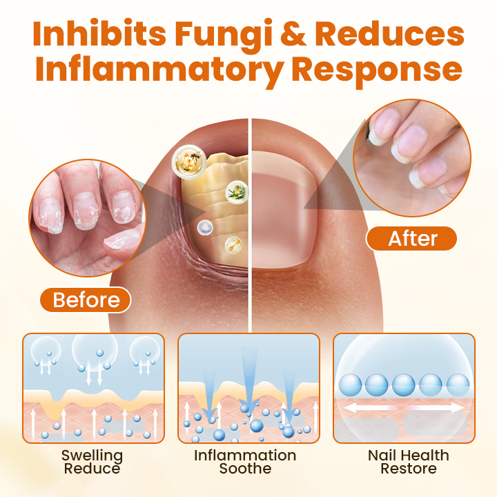 Timilk® FungiBee Advanced Nail Repair Spray⭐