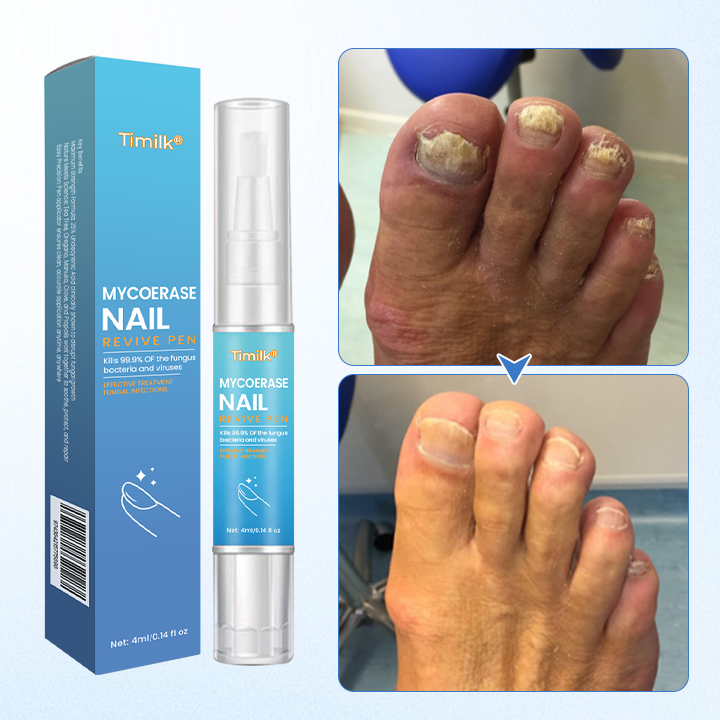 Timilk® MycoErase Nail Revive Pen⭐