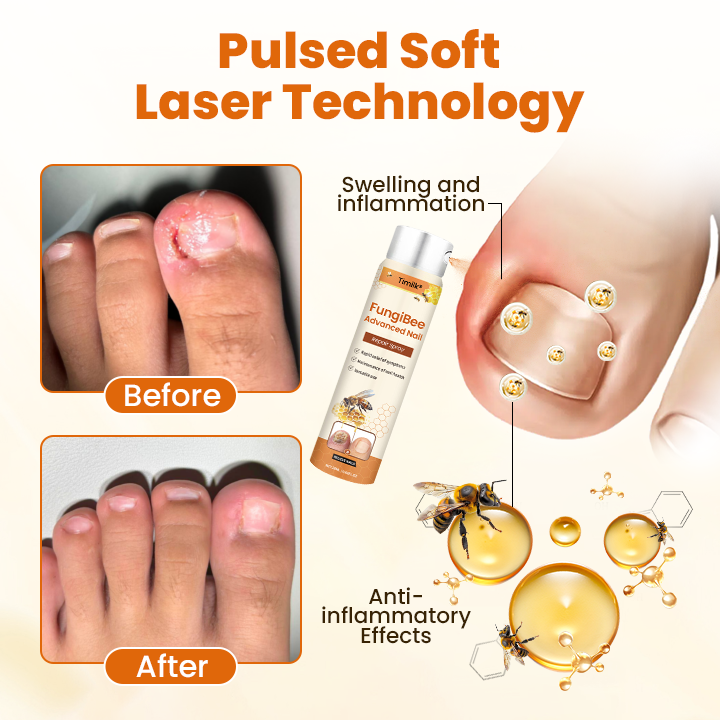 Timilk® FungiBee Advanced Nail Repair Spray⭐