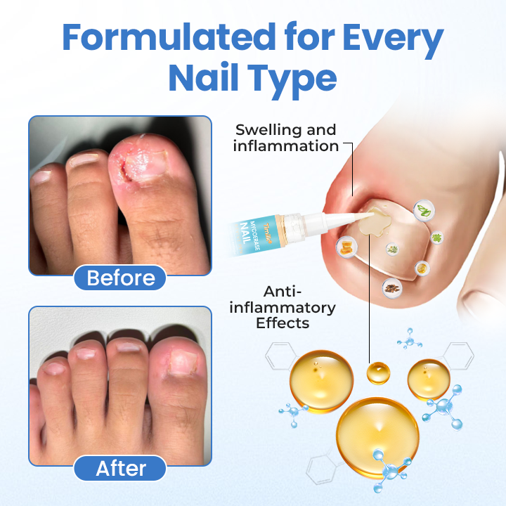 Timilk® MycoErase Nail Revive Pen⭐