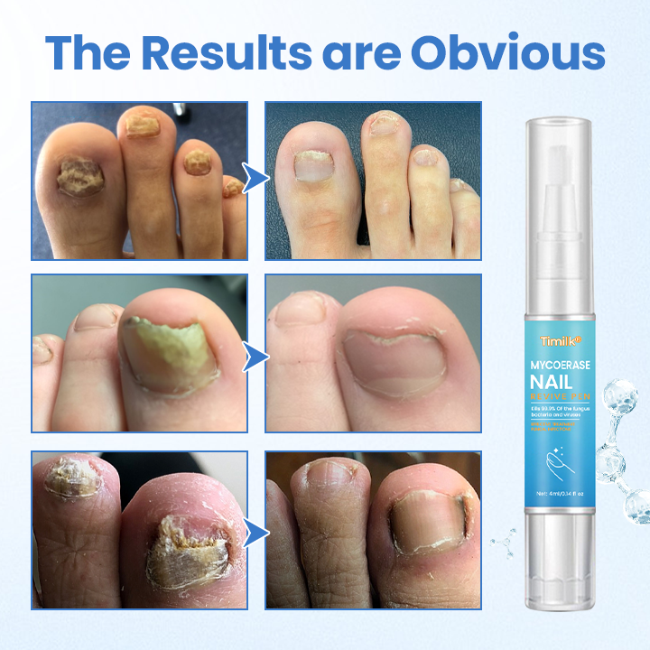 Timilk® MycoErase Nail Revive Pen⭐