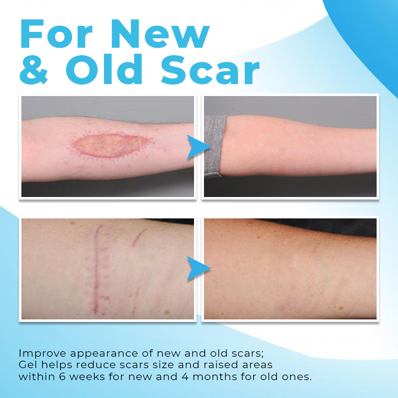 Biancat⢠PureHeal Scar Removing Gel