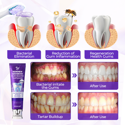 Biancat® BeeRenew Advanced Gum Healing Toothpaste