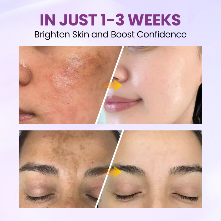 Biancat® RadiantClear Blemish & Brightening Serum