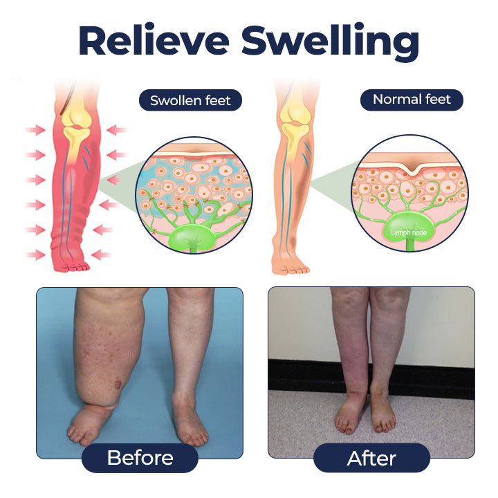 Timilk® SwellRelief Circulation Support Cream⭐