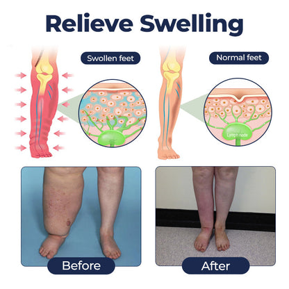 Timilk® SwellRelief Circulation Support Cream⭐