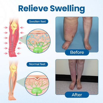 Timilk® Lymphora Swelling Relief Roll-On⭐