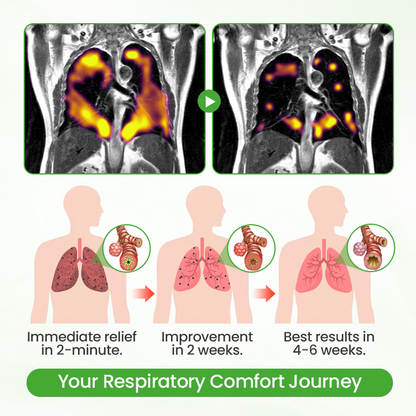 Timilk® HerbaAir Mullein Lung Purifier
