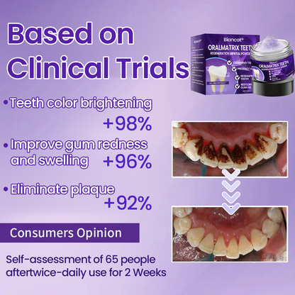 Biancat® OralMatrix Teeth Regeneration Mineral Powder