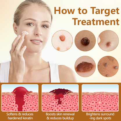 Timilk® BeeErase Multi-Action Renewal Cream