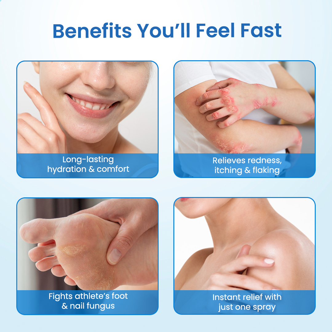 Timilk® MagnesiumHerb Psoriasis Relief Cream