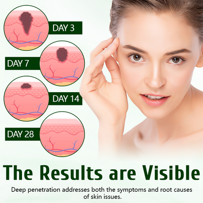 Timilk® DermaPure Tea Tree Healing Cream