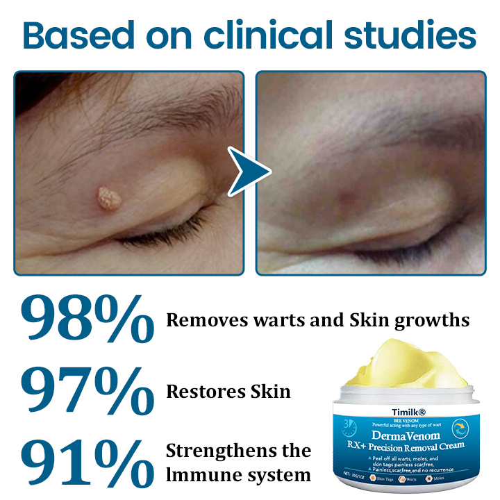 Timilk® DermaVenom RX+ Precision Removal Cream