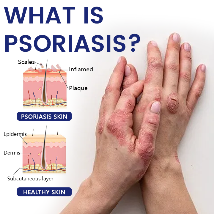 Timilk® DermaSooth Repair Cream