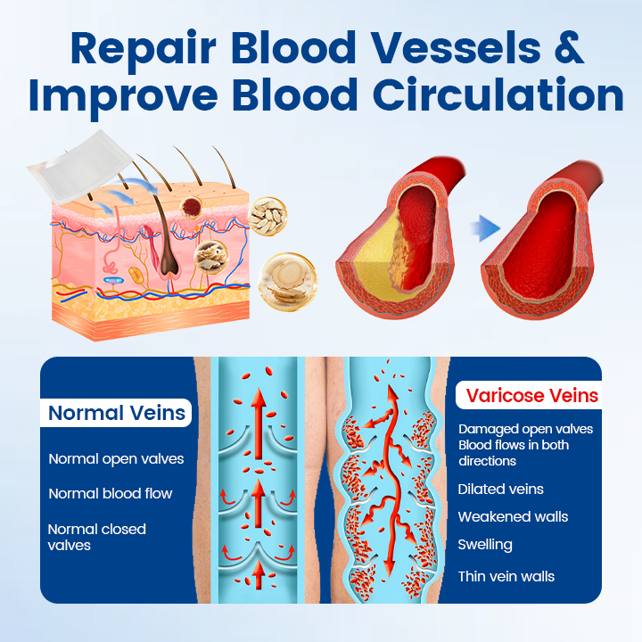 Timilk® Vein Ease Microneedle Therapy Patch - Fast ⚡Effective 💪 and Non-Invasive 🚫 Treatment for Varicose Veins & Leg Swelling 👣