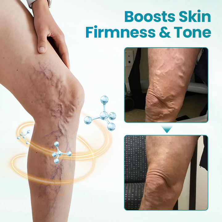 Timilk® VeinAway Relief Cream