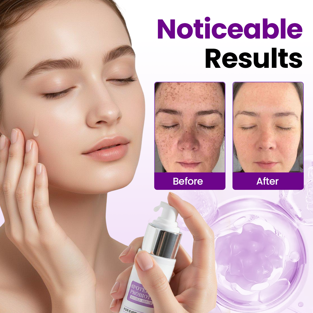 Biancat® SpotErase Probiotic Shield Serum⭐