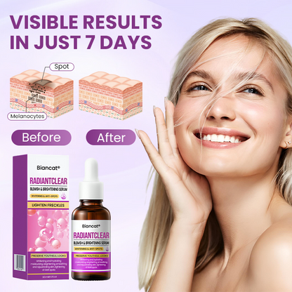 Biancat® RadiantClear Blemish & Brightening Serum