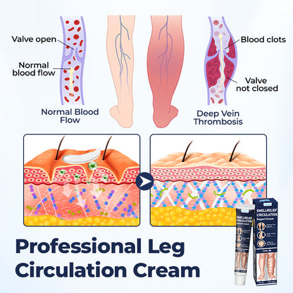 Timilk® SwellRelief Circulation Support Cream⭐